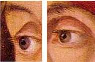 Grien, Loewenstein, Augen